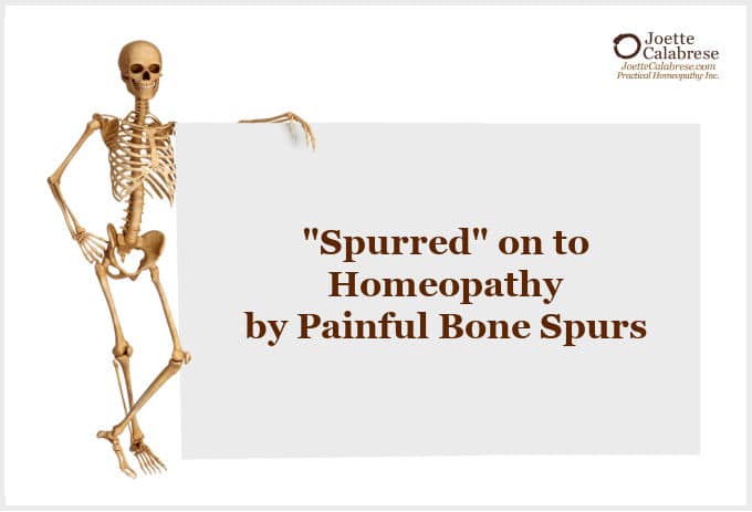 Joette Calabrese, Practical Homeopathy, Bone Spurs