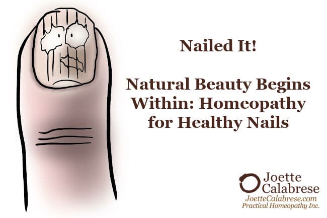 Joette Calabrese, Practical Homeopathy®, Nailed It! Natural Beauty Begins Within: Homeopathy for Healthy Nails