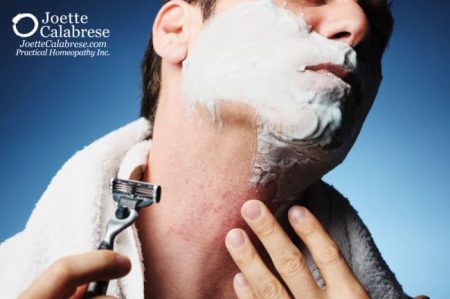 Joette Calabrese, Practical Homeopathy, 3 Effective Homeopathic Topical Medicines to Make a Boo-Boo Better